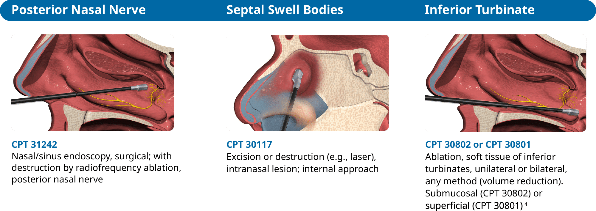 illustrated nose side profile